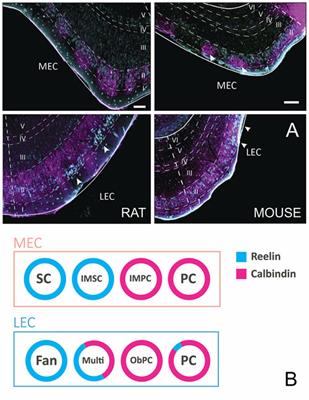 Architecture of the Entorhinal Cortex A Review of Entorhinal Anatomy in Rodents with Some Comparative Notes